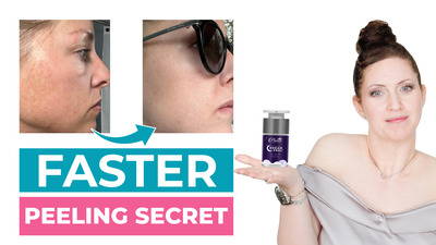 Standalone Peel or Booster? Master the Dream Peel