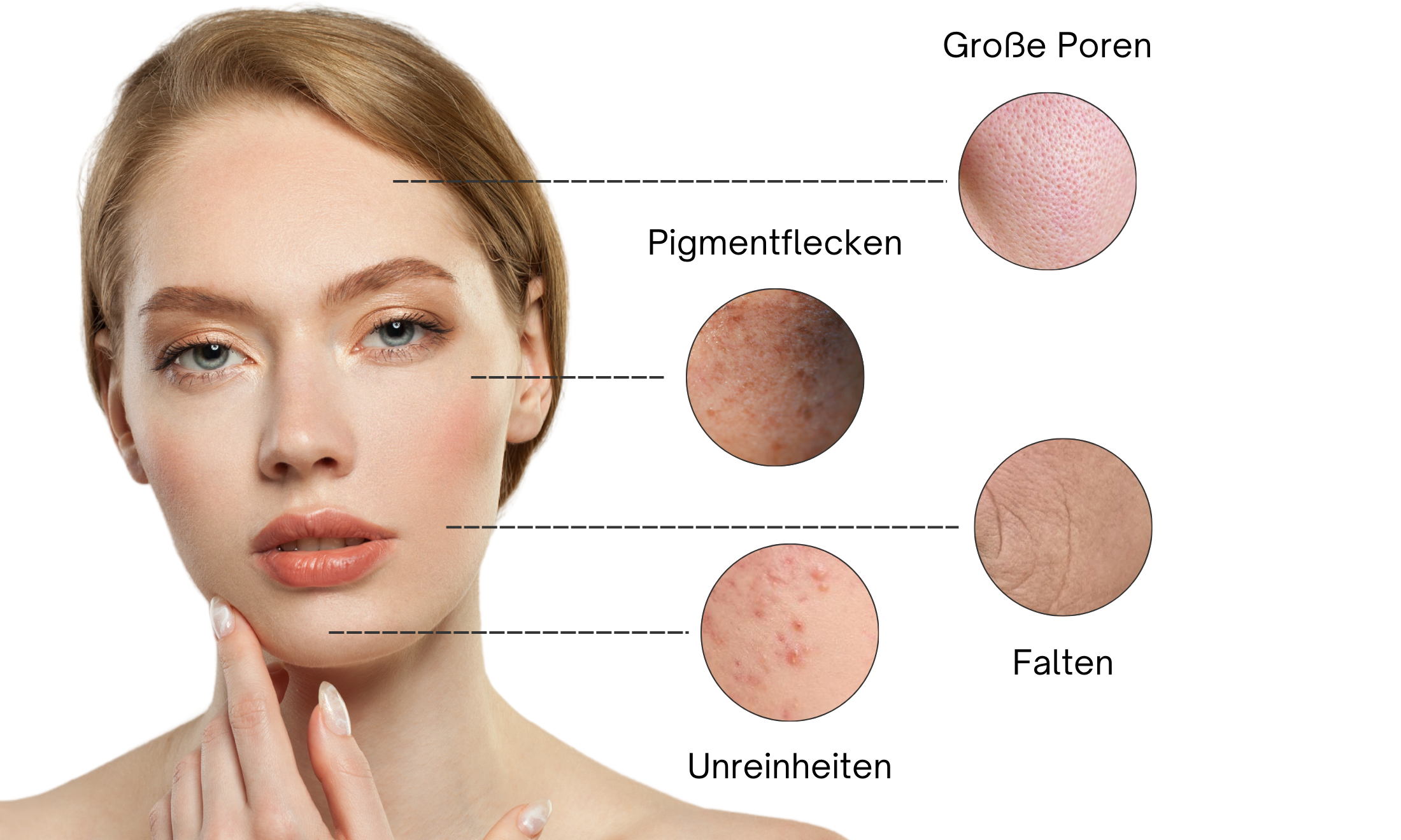 iS Clinical Active Serum bei Facial Room Skincare für große Poren Pigmentflecken Falten Unreinheiten