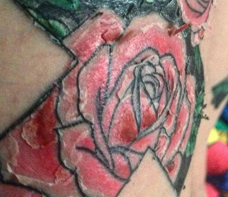 normal tattoo peeling red tattoo