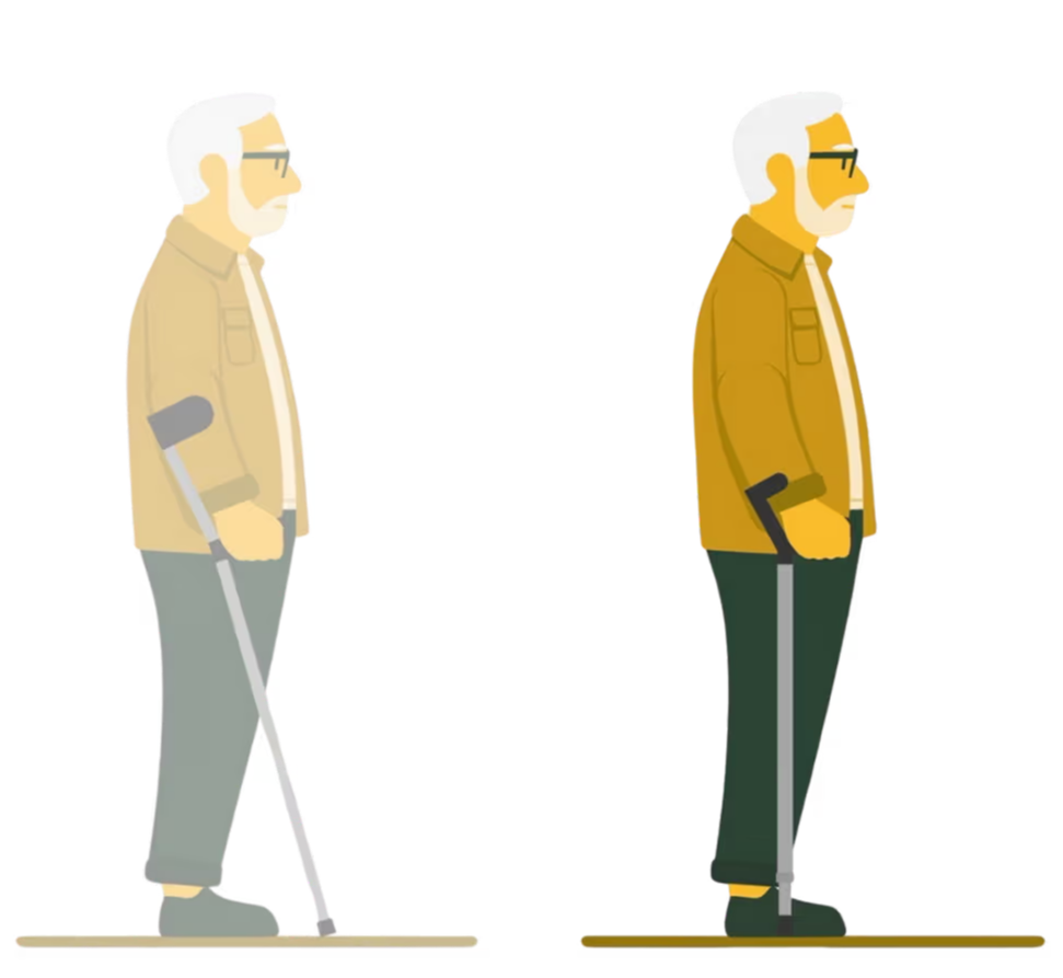 Side-by-side illustration comparing an older man using forearm crutches on the left with the same man using the Y-Cane on the right. The forearm crutches are angled forward while the Y-Cane is in-line with the leg.