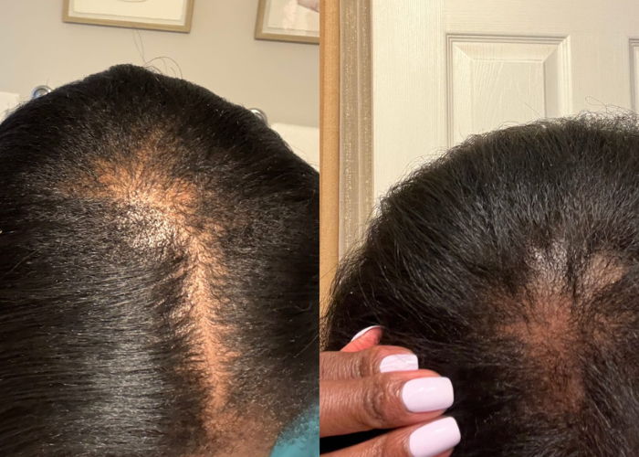 Straight lace frontal wig