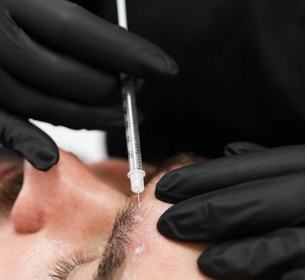 Man getting Botox at Prolase
