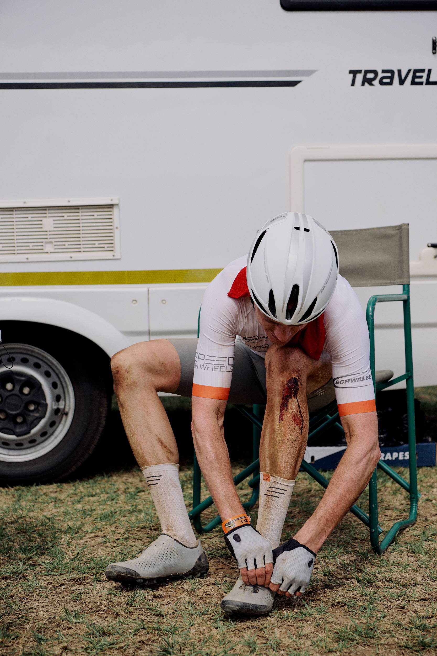 Cyclist sitting down with blood on his knee