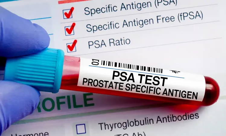 Understanding the PSA Test: What It Measures, What It Doesn't