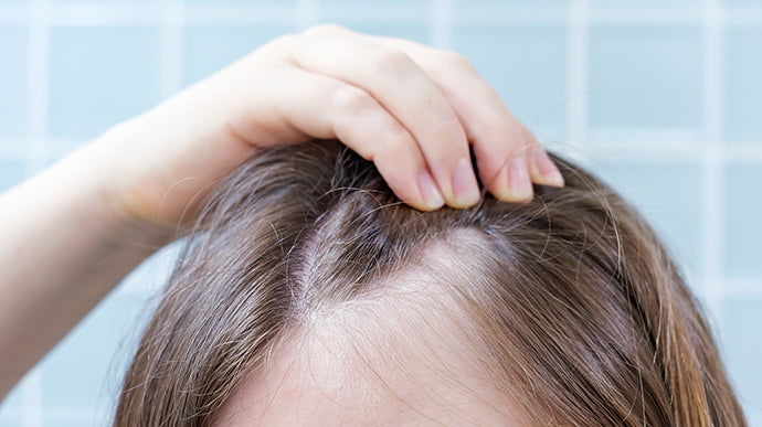 Hair thinning and stress