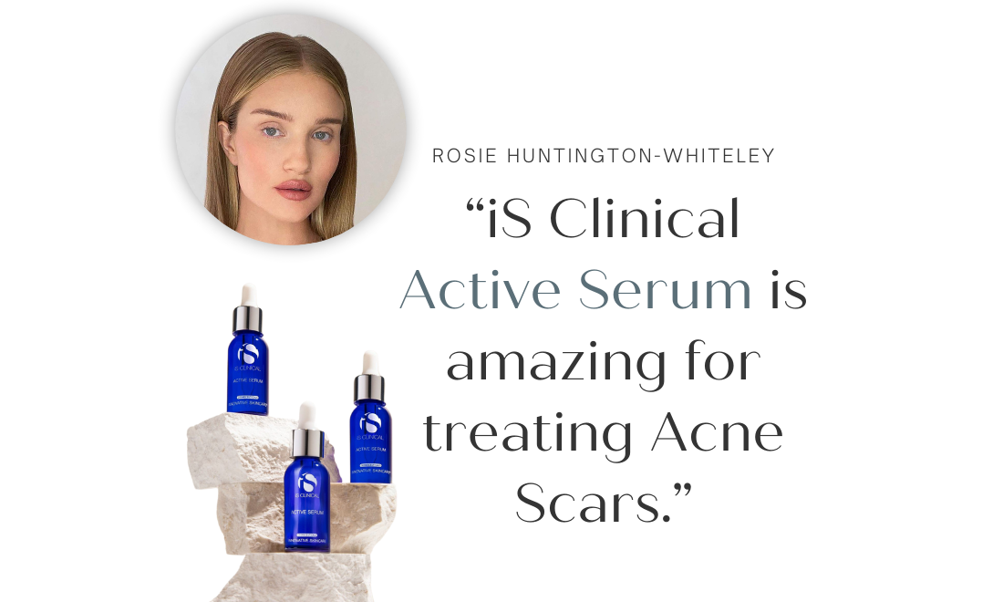 Rosie Huntington-Whiteley spricht über iS Clinical Active Serum - Perfekte Pflege gegen Akne