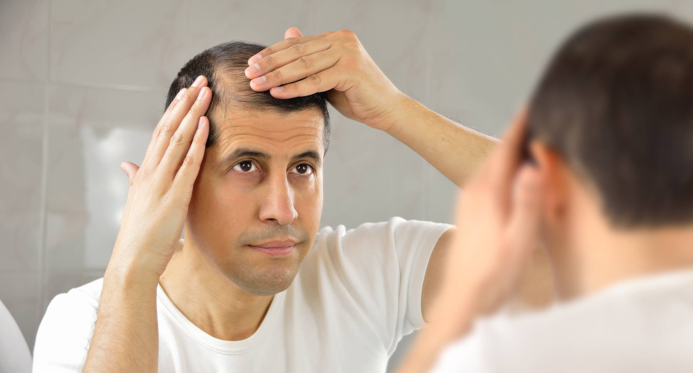 The Parts of Head & Scalp Explained for Hair Loss – DS Healthcare Group