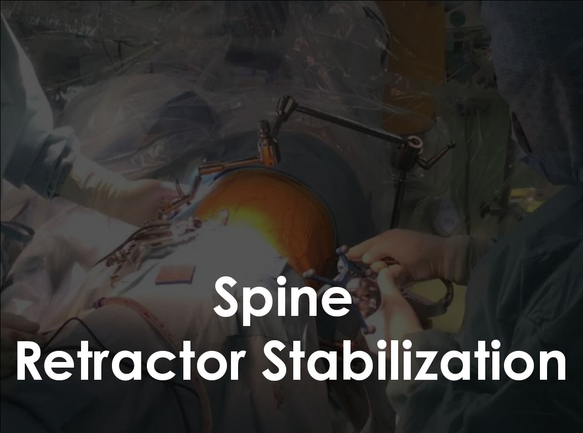 Photo of surgery being performed with Mediflex Spine Retractor Stabilization