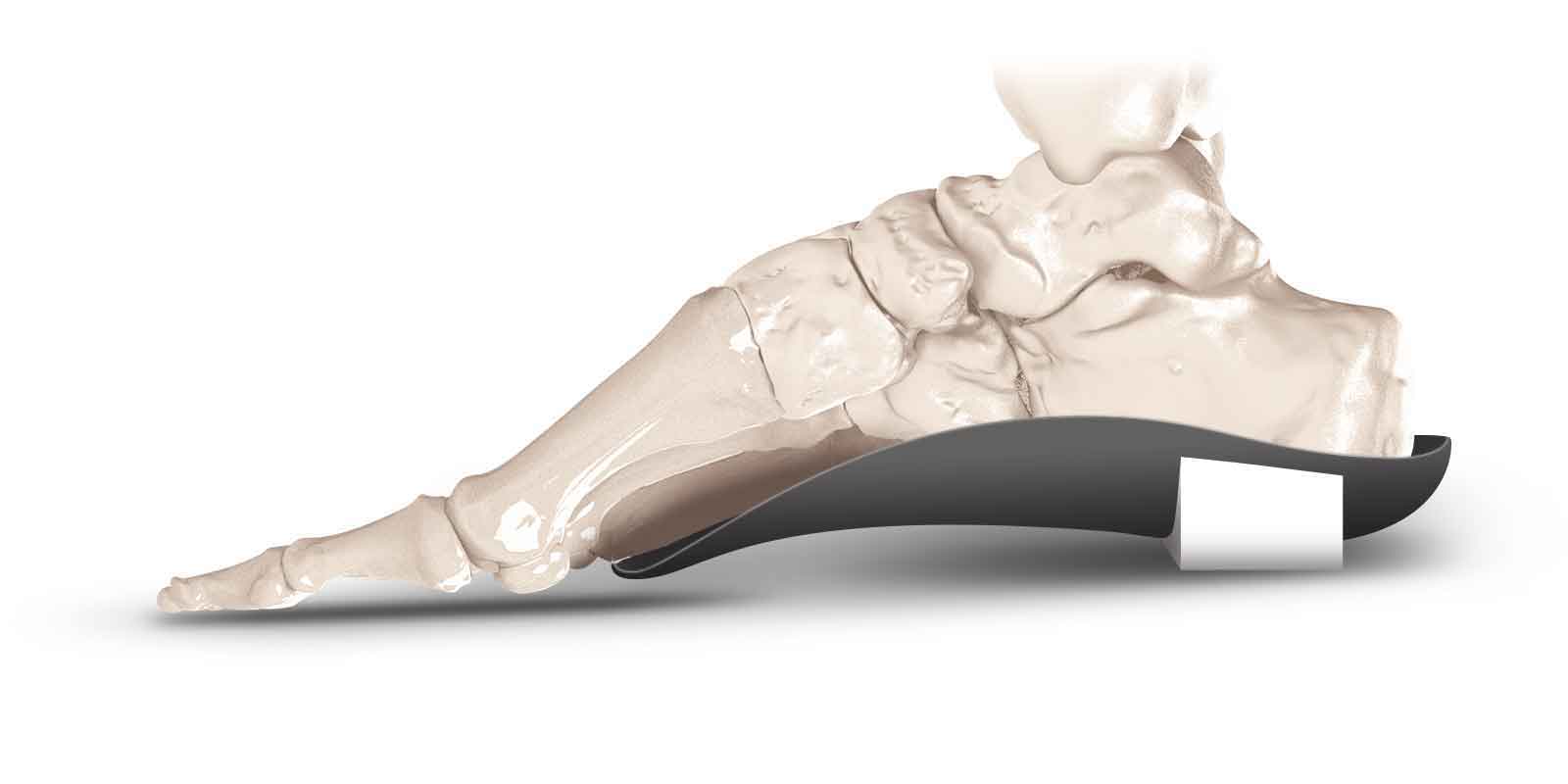Proximal Post Grind Off – KevinRoot Medical