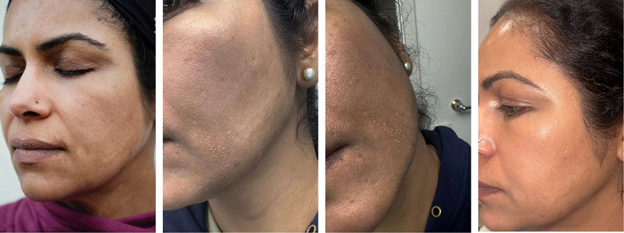 Four close-up profiles of a woman's face showing different angles and expressions.