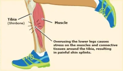 tibia and muscle look