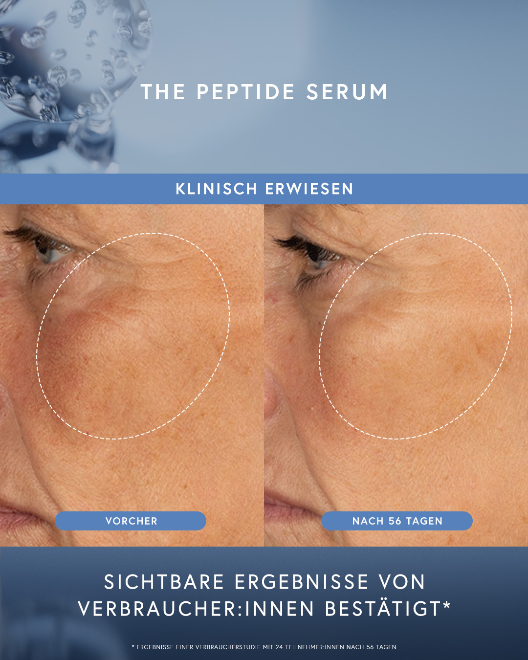 Comparison of skin before and after using peptide serum.