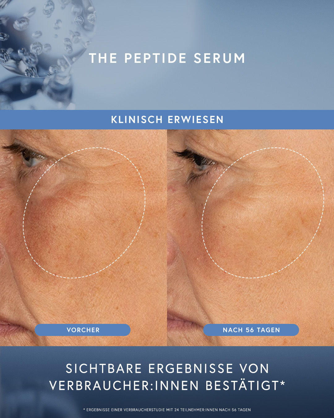 Comparison of skin before and after using peptide serum.