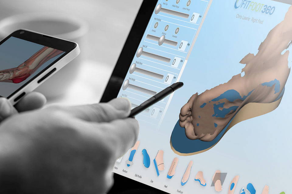 FitFoot360 CAD/CAM interface — orthotic surface modification