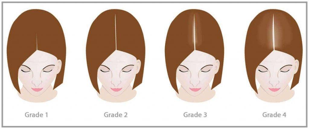 The Most Common Hair Concerns among Women Over 40 – Dr. Wolff Official  Store (Singapore)