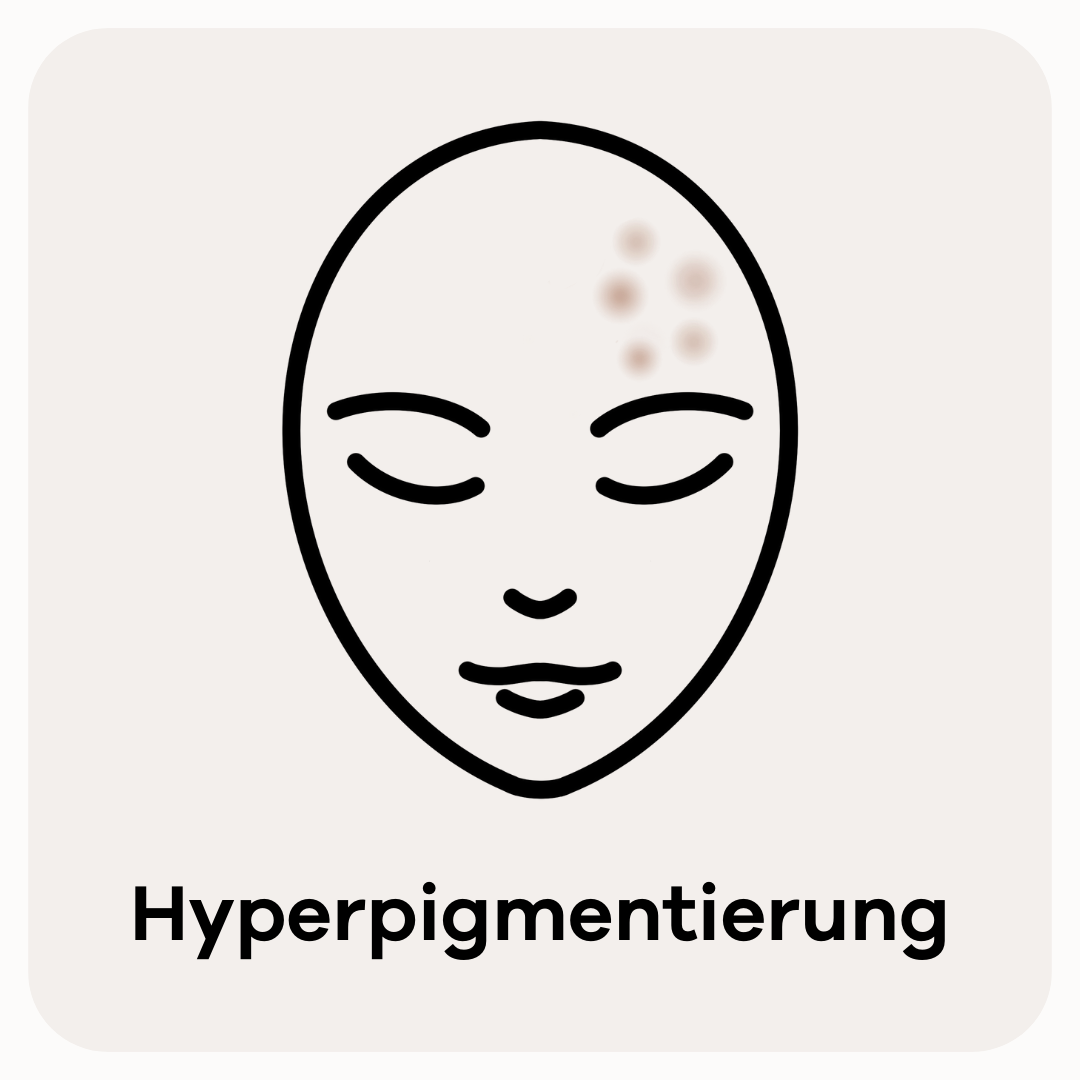 Hyperpigmentierung Skincerely Yours Hautprobleme Startseite