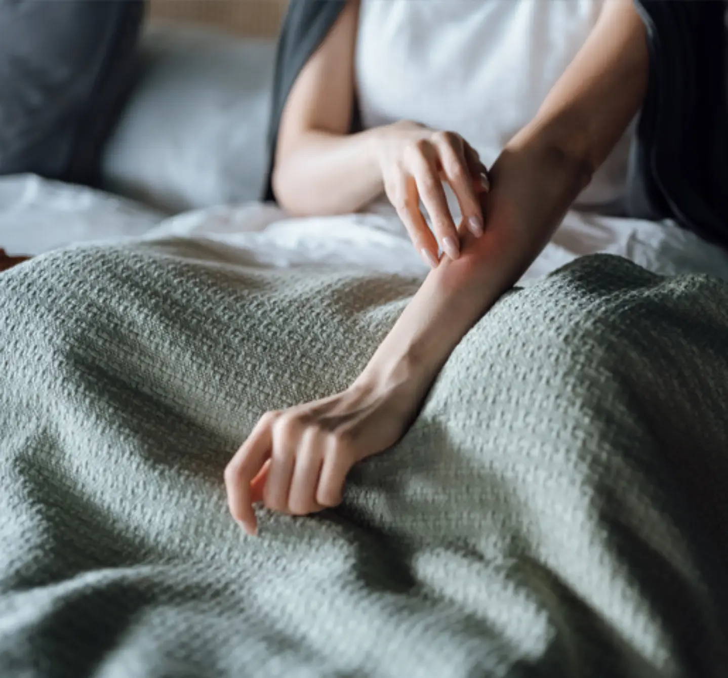Frau im Bett, die sich ihren gereizten Arm kratzt, möglicherweise aufgrund eines allergischen Milbenausschlags 