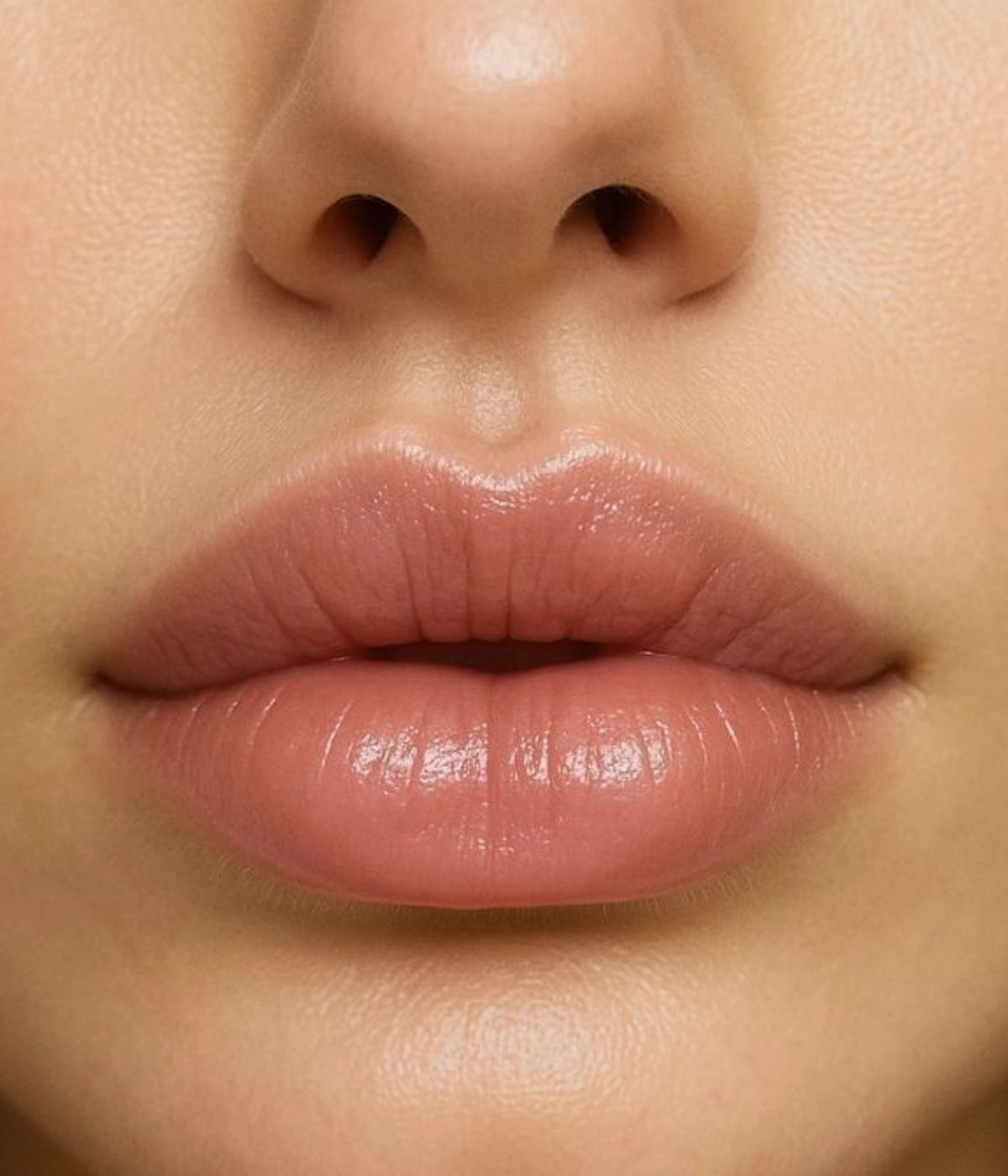 Prolase Medspa May Specials Filler