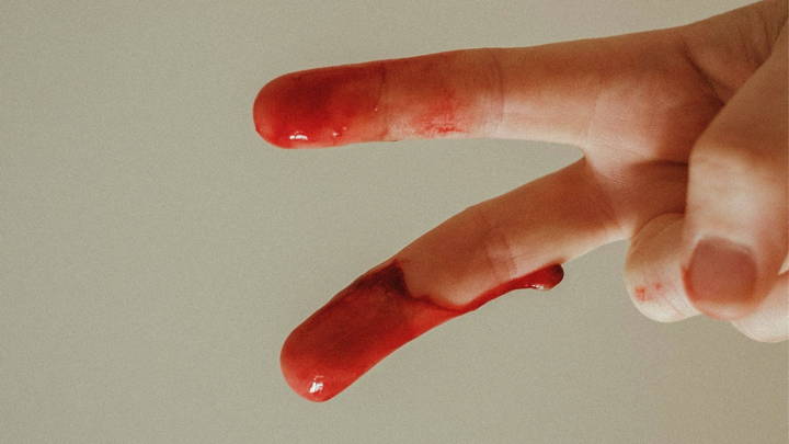 Blood on fingers