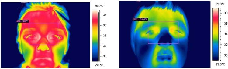 Coronavirus Fever Detection Using FLIR A320 Infrared Thermal Cameras GoThermal