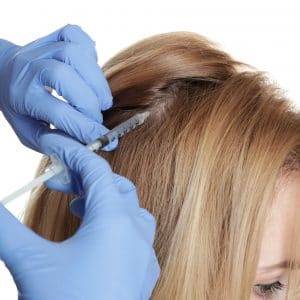 Using Platelet-Rich Plasma (PRP) to Treat Hair Loss – Capillus