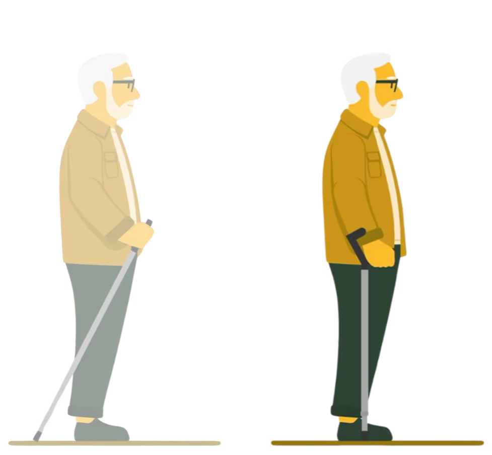 Side-by-side illustration comparing an older man using a trekking pole on the left with the same man using the Y-Cane on the right. The trekking poles are angled backwards while the Y-Cane is in-line with the leg.