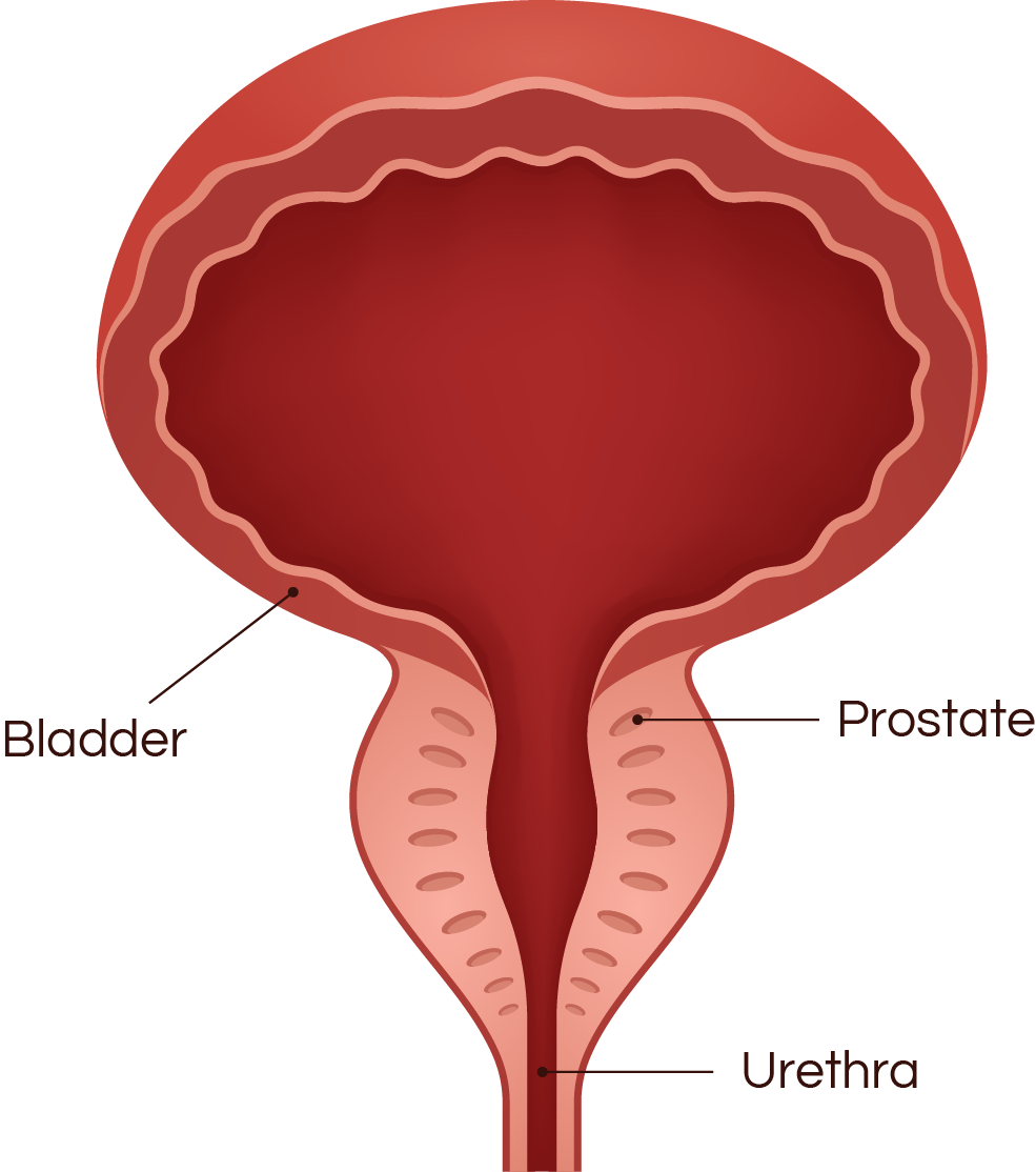 Diagram of male urinary system showing bladder, prostate, and urethra.