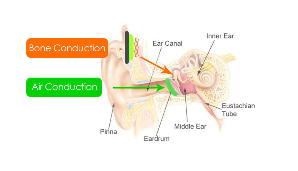 How Bone Conduction Headphones Work