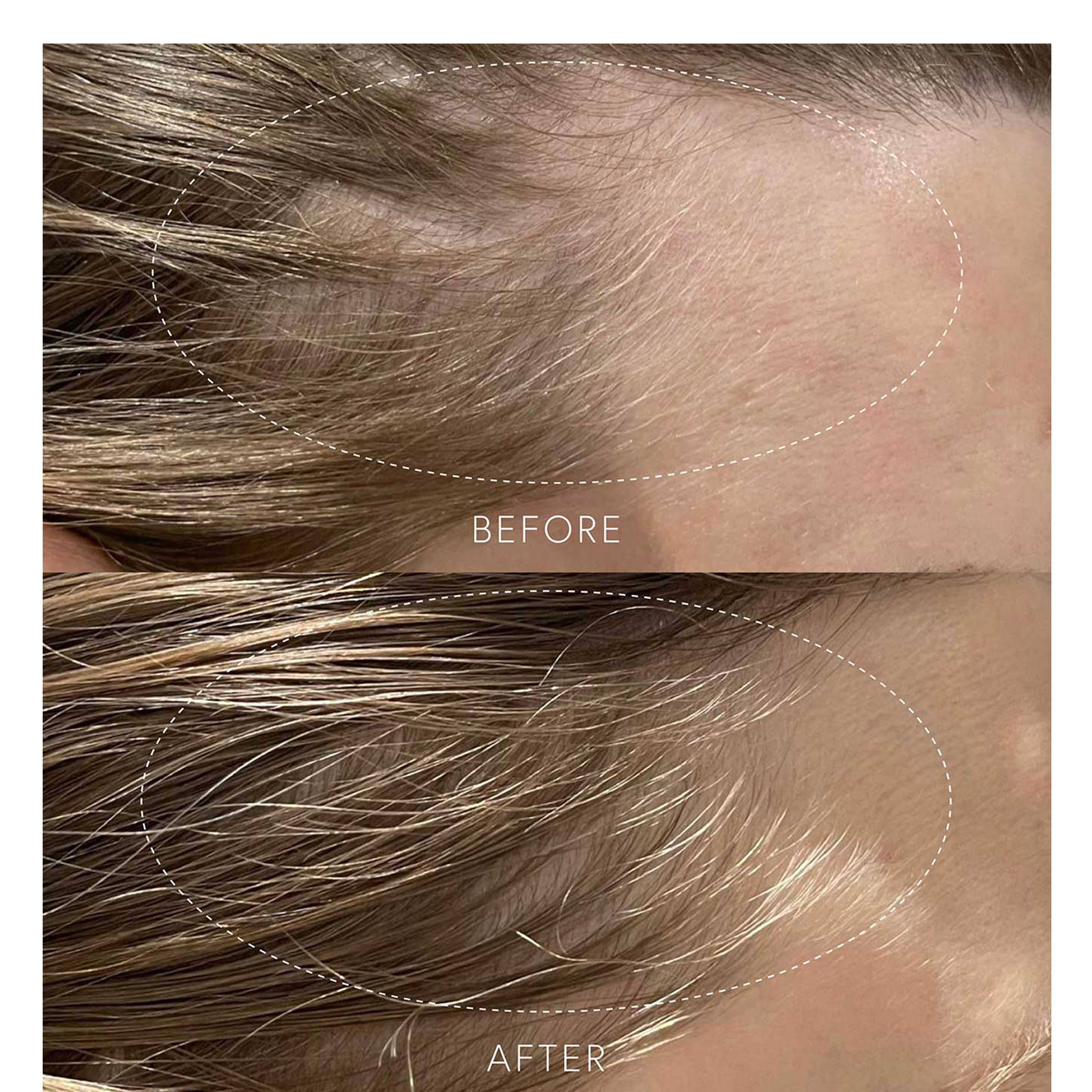 Before and After image of the GROWTH CYCLE HAIR SUPPLEMENT