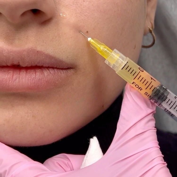 Paitent getting PRP injection at Prolase