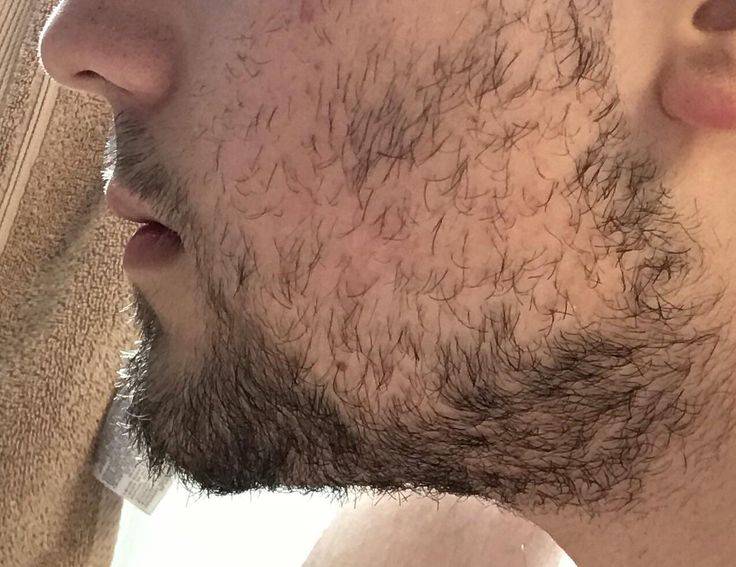 Sparse Beard Growth