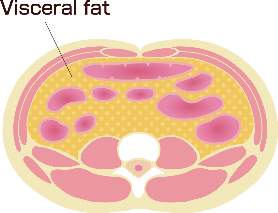Diagram showing visceral fat in cross-section of human body.