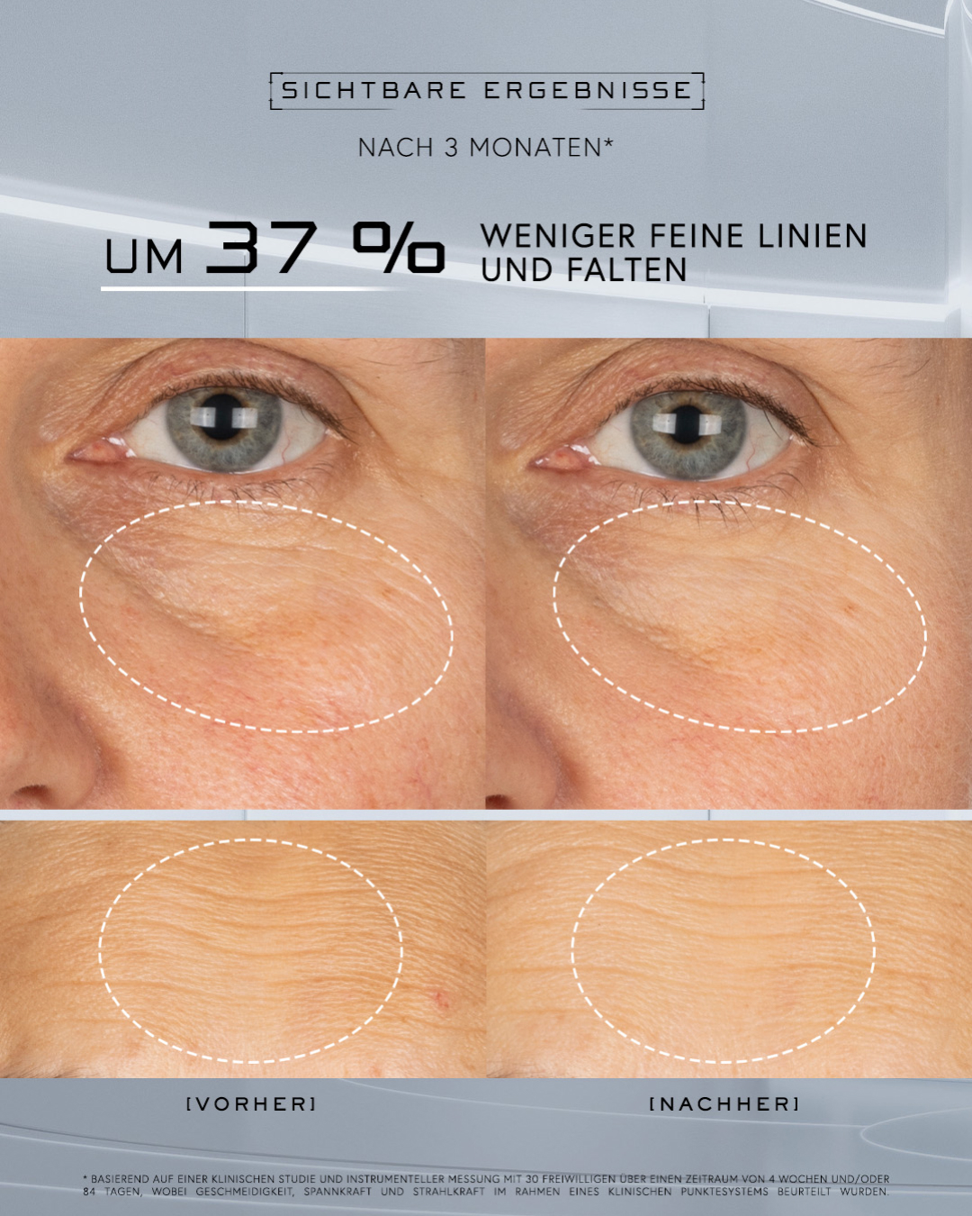 Comparison of skin before and after treatment, showing reduced fine lines and wrinkles.