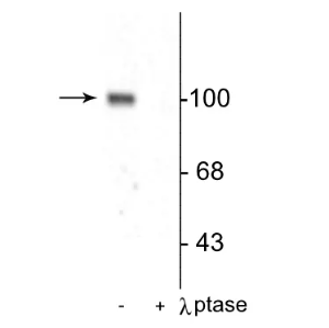 Phosphatase specificity