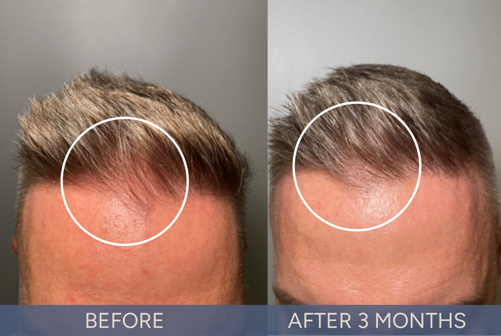DeriveMD Before & After Results