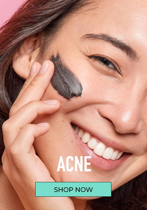 Skin Care Concern Acne