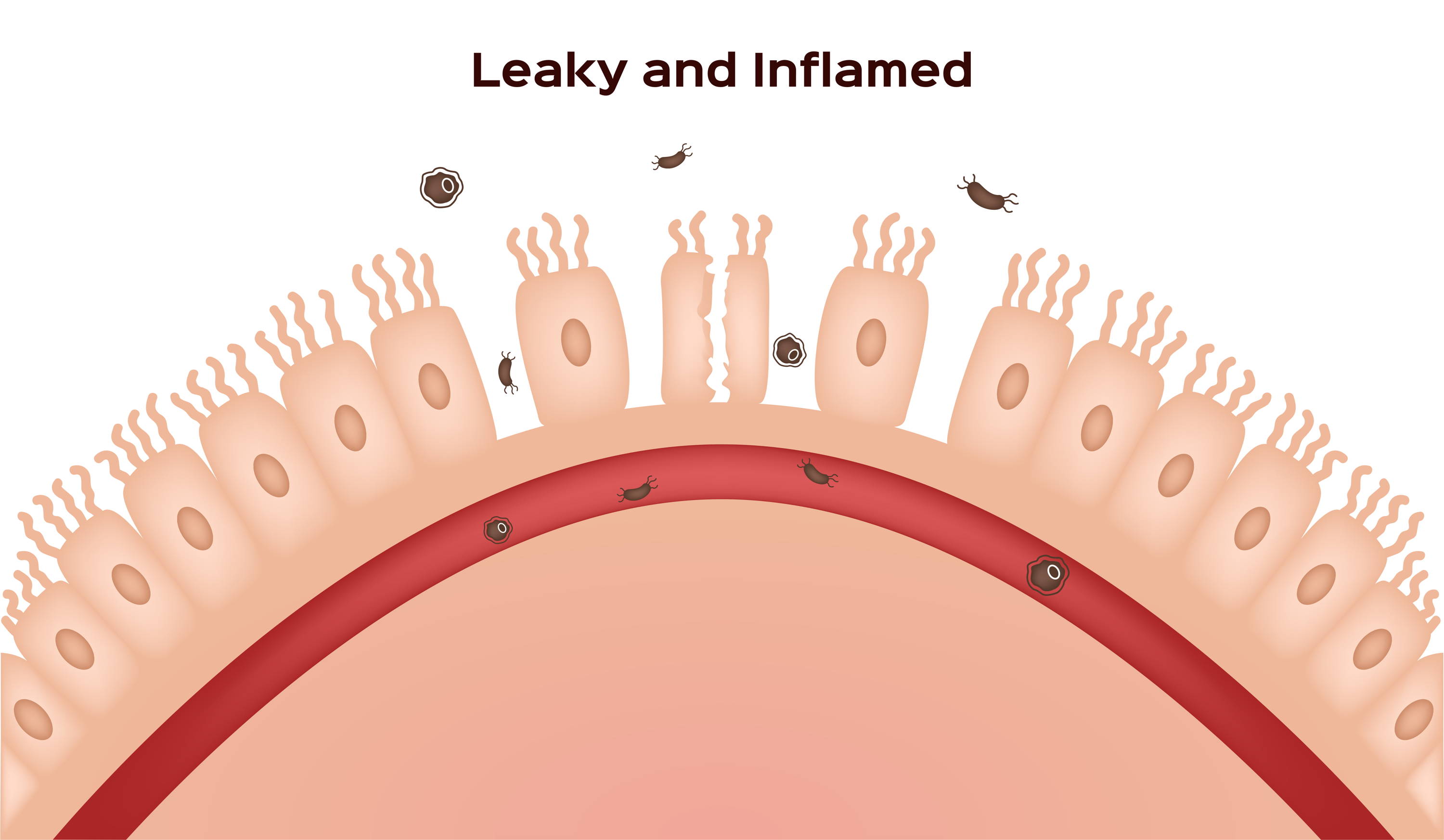 repair-leaky-gut-with-collagen