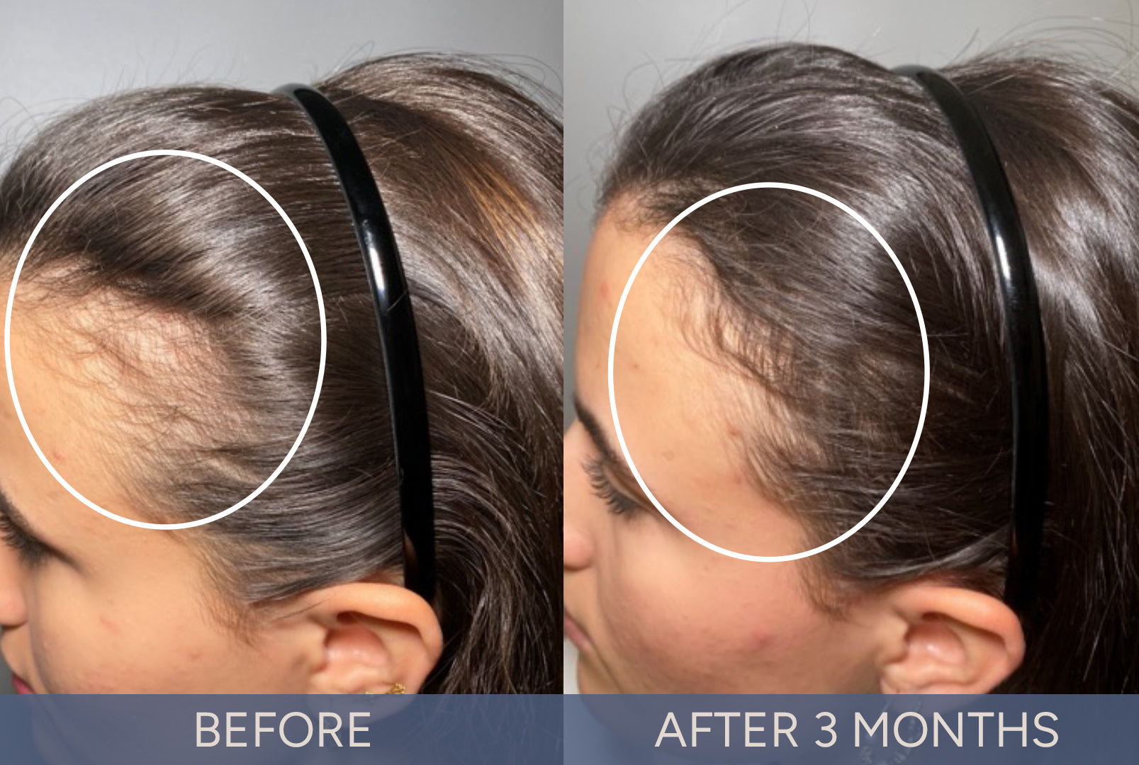 DeriveMD Before & After Results