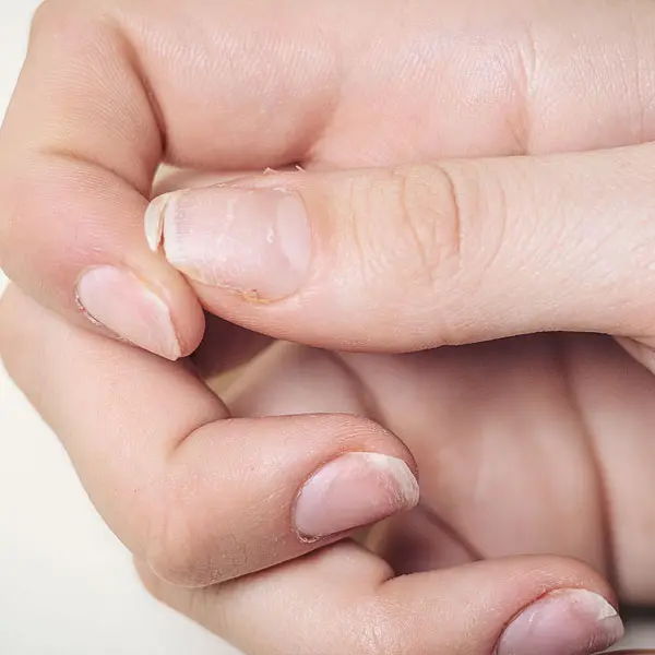 What Happens When You're Deficient?