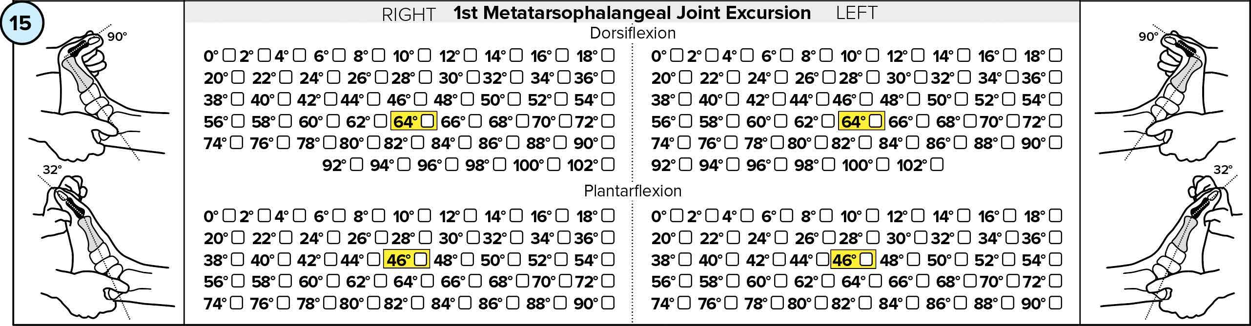 1st Metatarsophalangeal Joint Excursion