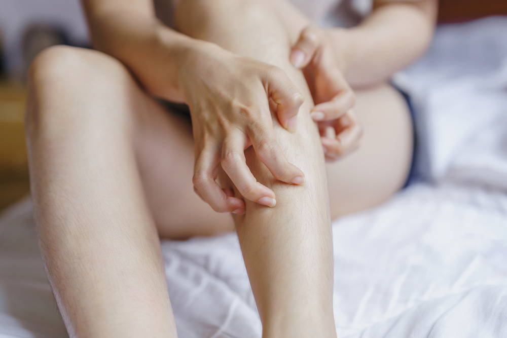 Imagen de una mujer rascándose la pierna