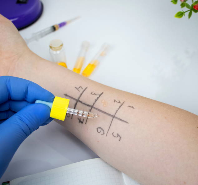 Child having a skin prick test, their forearms resting on the table while the [CA: doctor] puts drops of liquid onto their skin