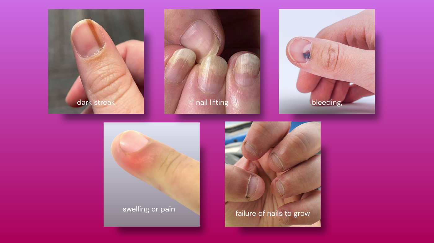 Illustration highlighting nail health warning signs that require a professional, including dark streaks, nail lifting, swelling, bleeding, persistent pain, and possible fungal infections