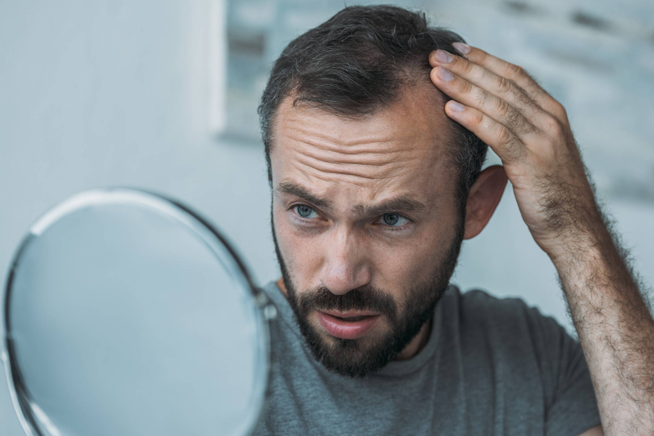 Can Stress Cause Thinning Hair on the Crown? – DS Healthcare Group
