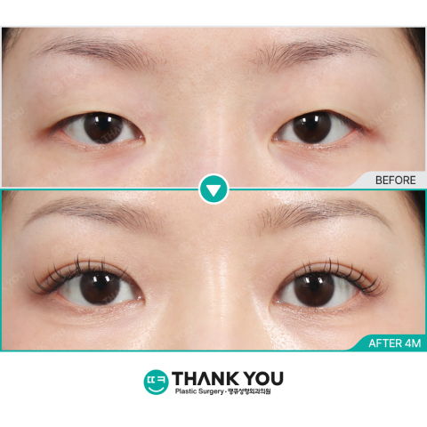 Understanding Plastic Surgery Recovery Timeline and Realistic Healing Expectations After Surgery