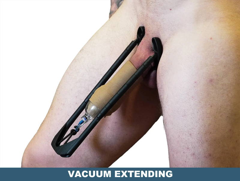 vacuum penis extender