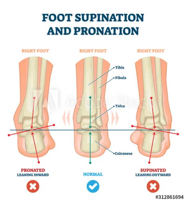 Supination and Footwear: Effects on the Body