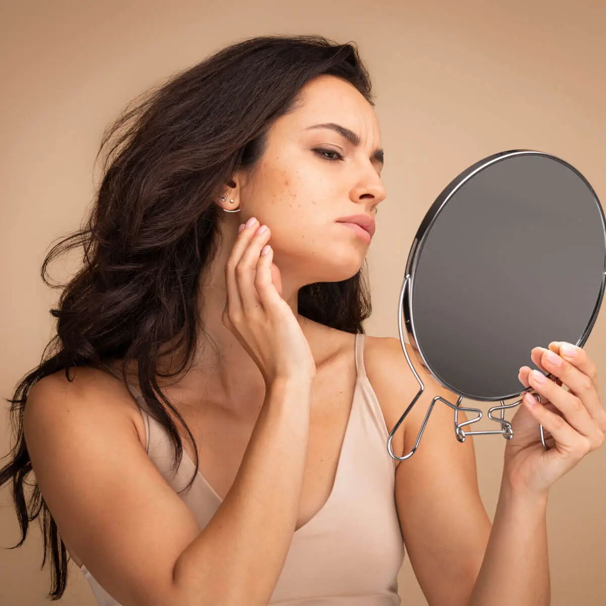 What Is Skin Purging?