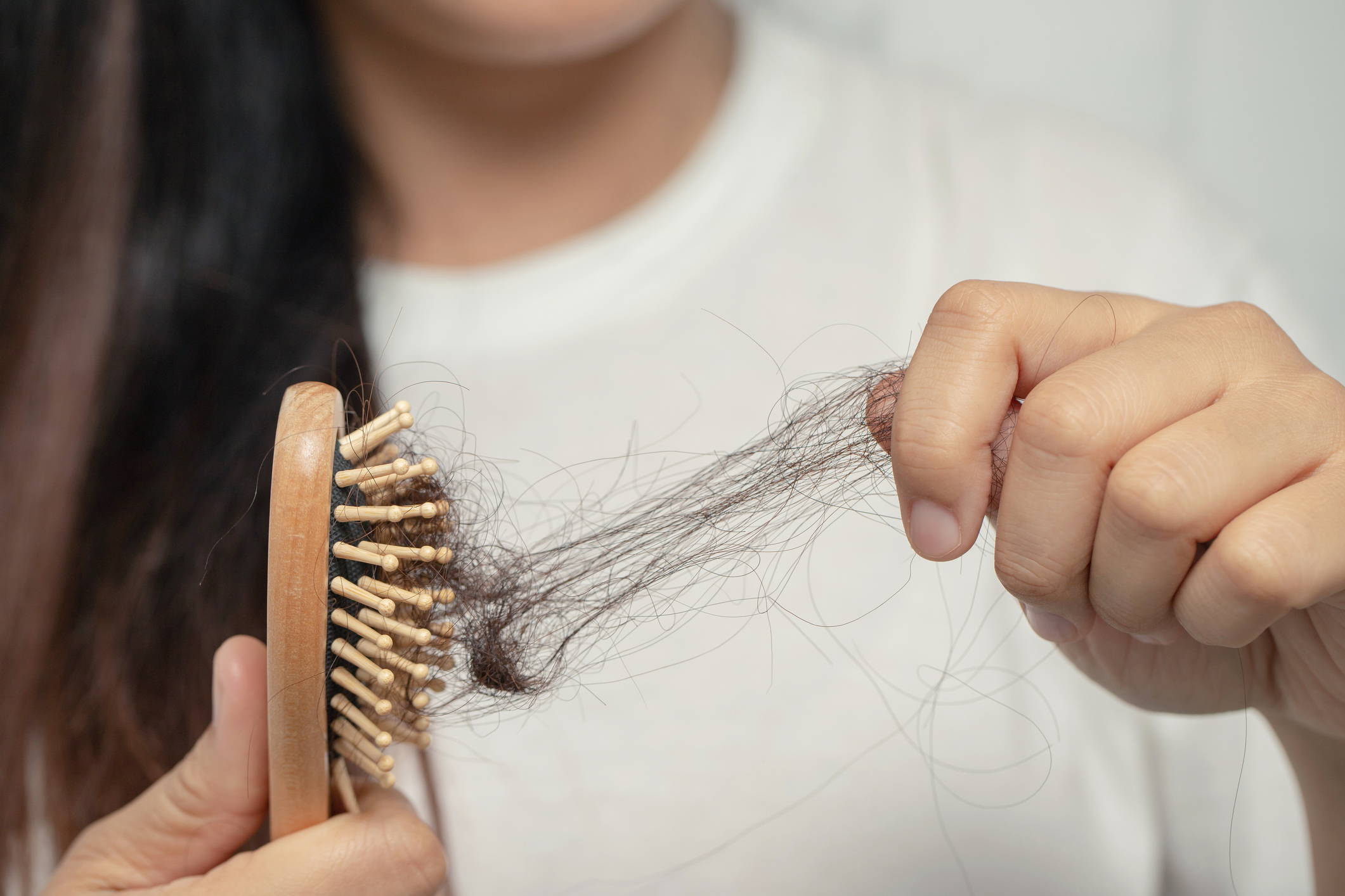 4 Triggers of Hair Loss: Genetic, Autoimmune, Diet, Inflammation – DS  Healthcare Group