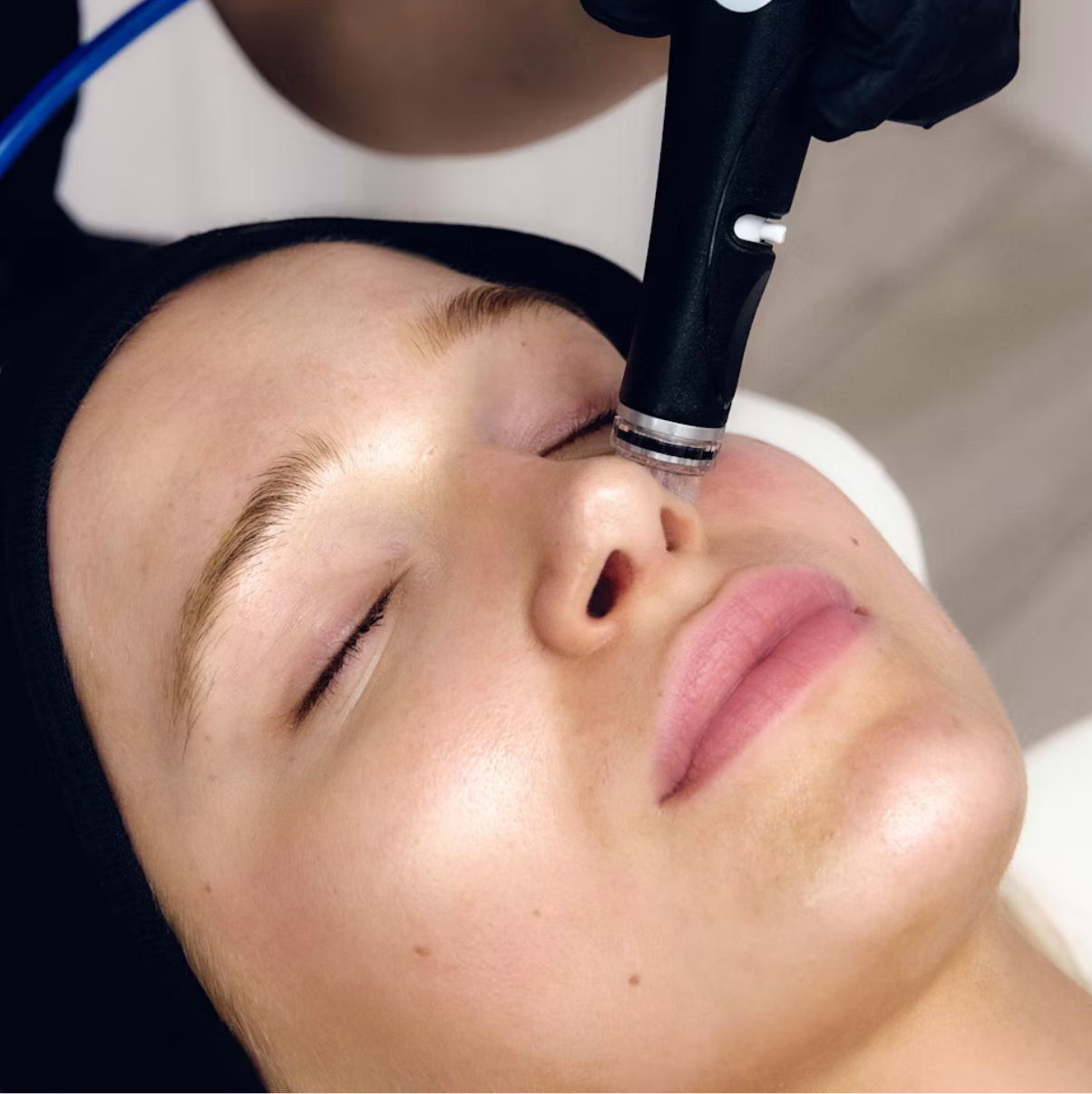 HydraFacial MD treatment being performed at The Body Clinic Day Spa in Mississauga